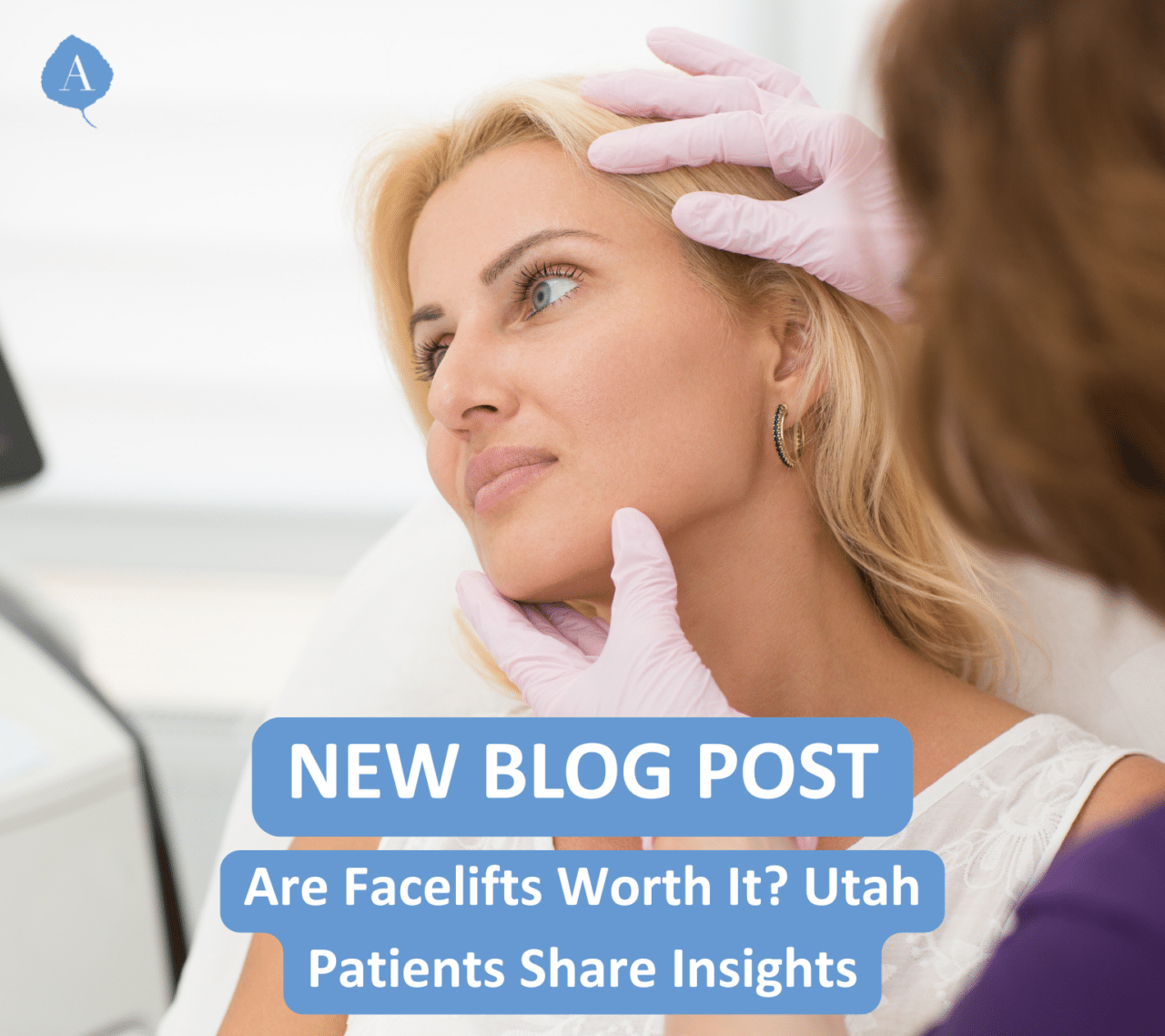 Should you consider a facelift?