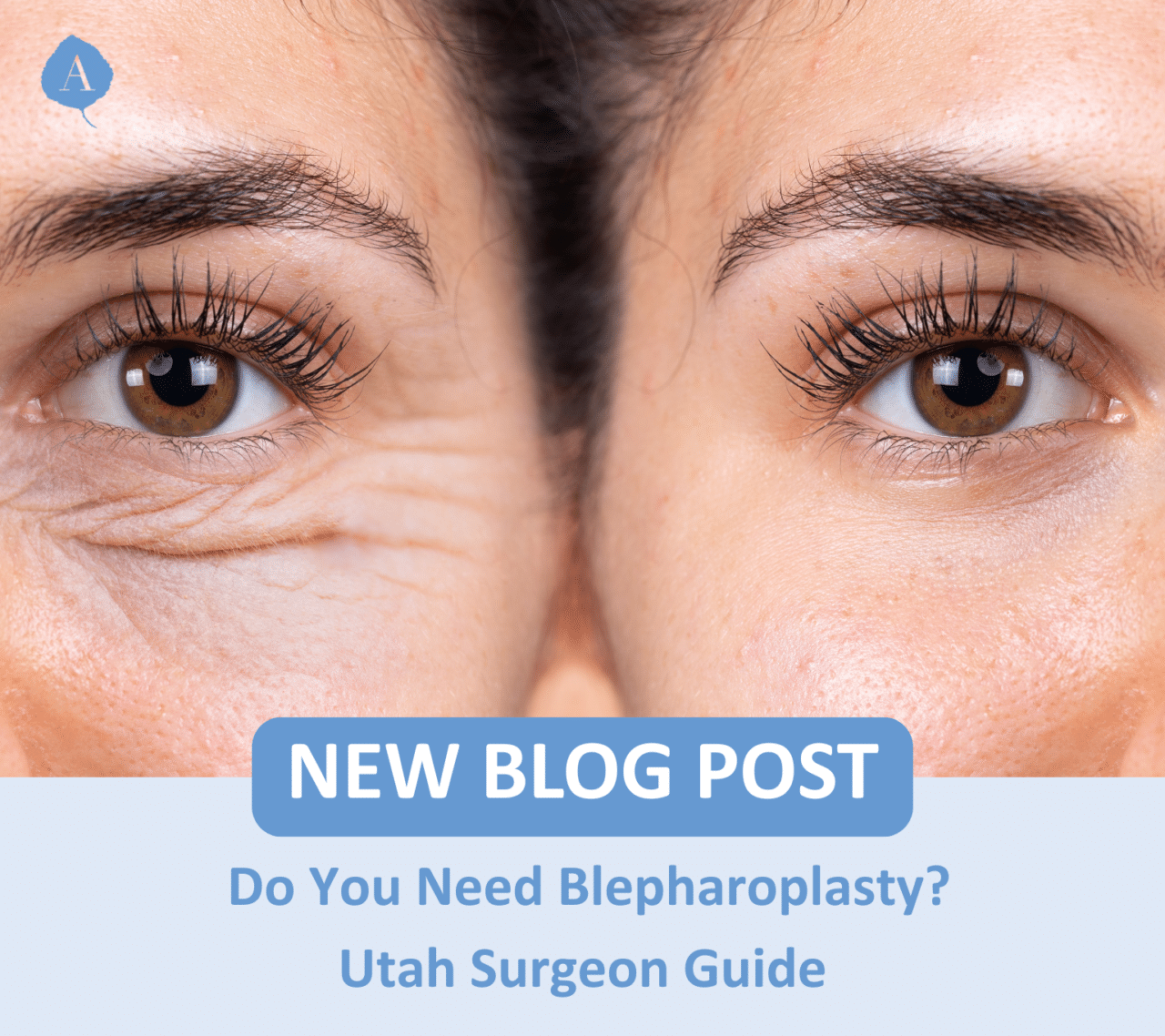 Have droopy eye lids? Bags under your eyes? Is your vision impaired? Want to look more youthful?