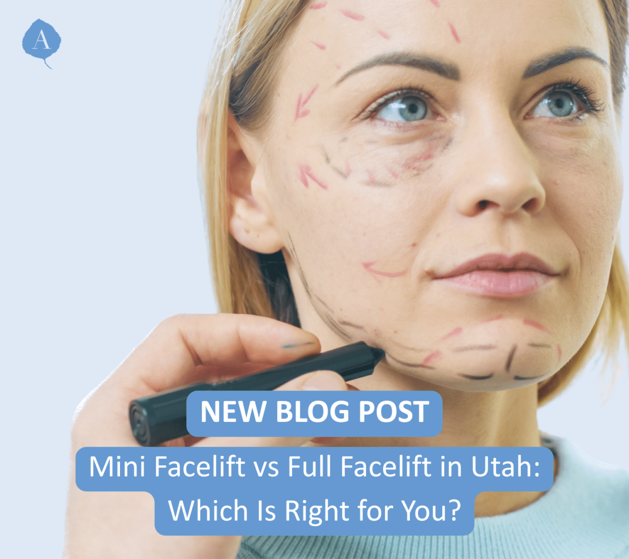 The difference between mini facelifts vs a full facelifts 