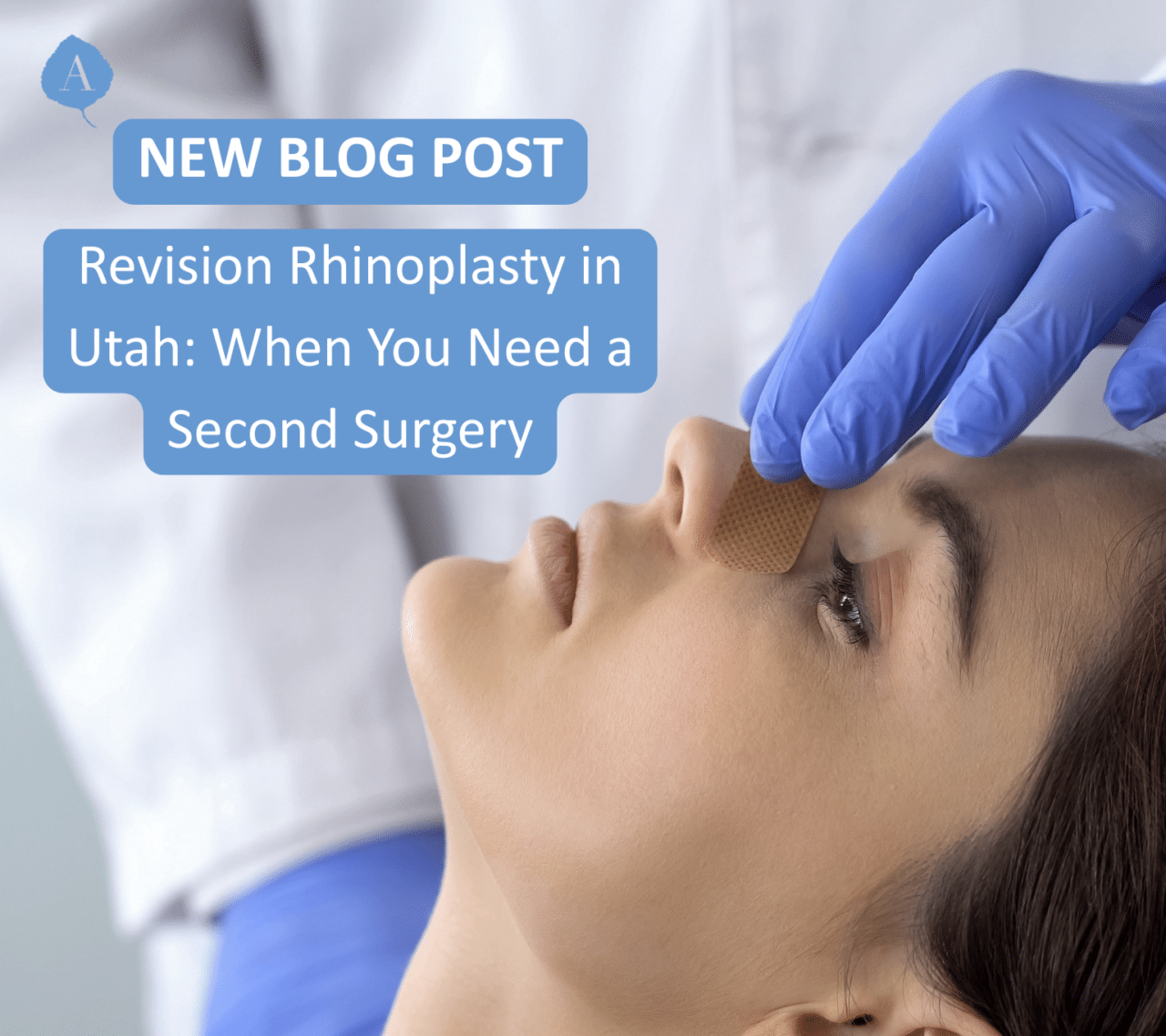 Revision rhinoplasty at aspen facial plastics
